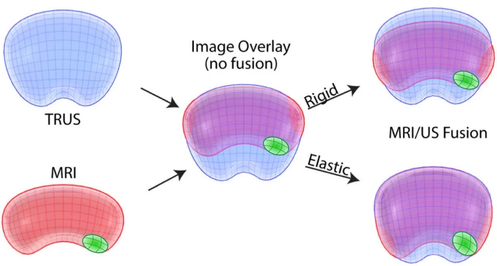 rigid vs elastic registration