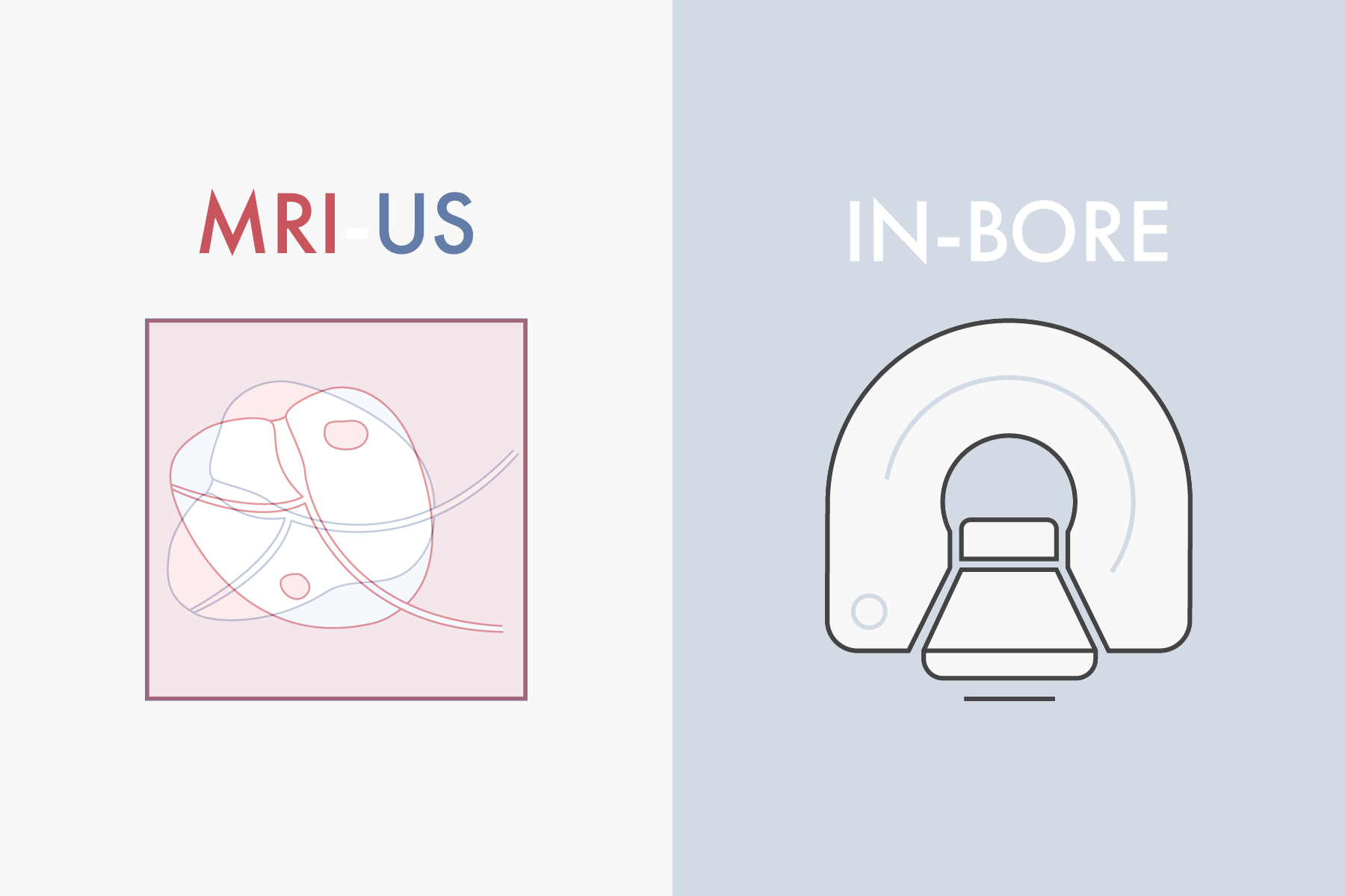 MRI-US fusion vs MRI in bore