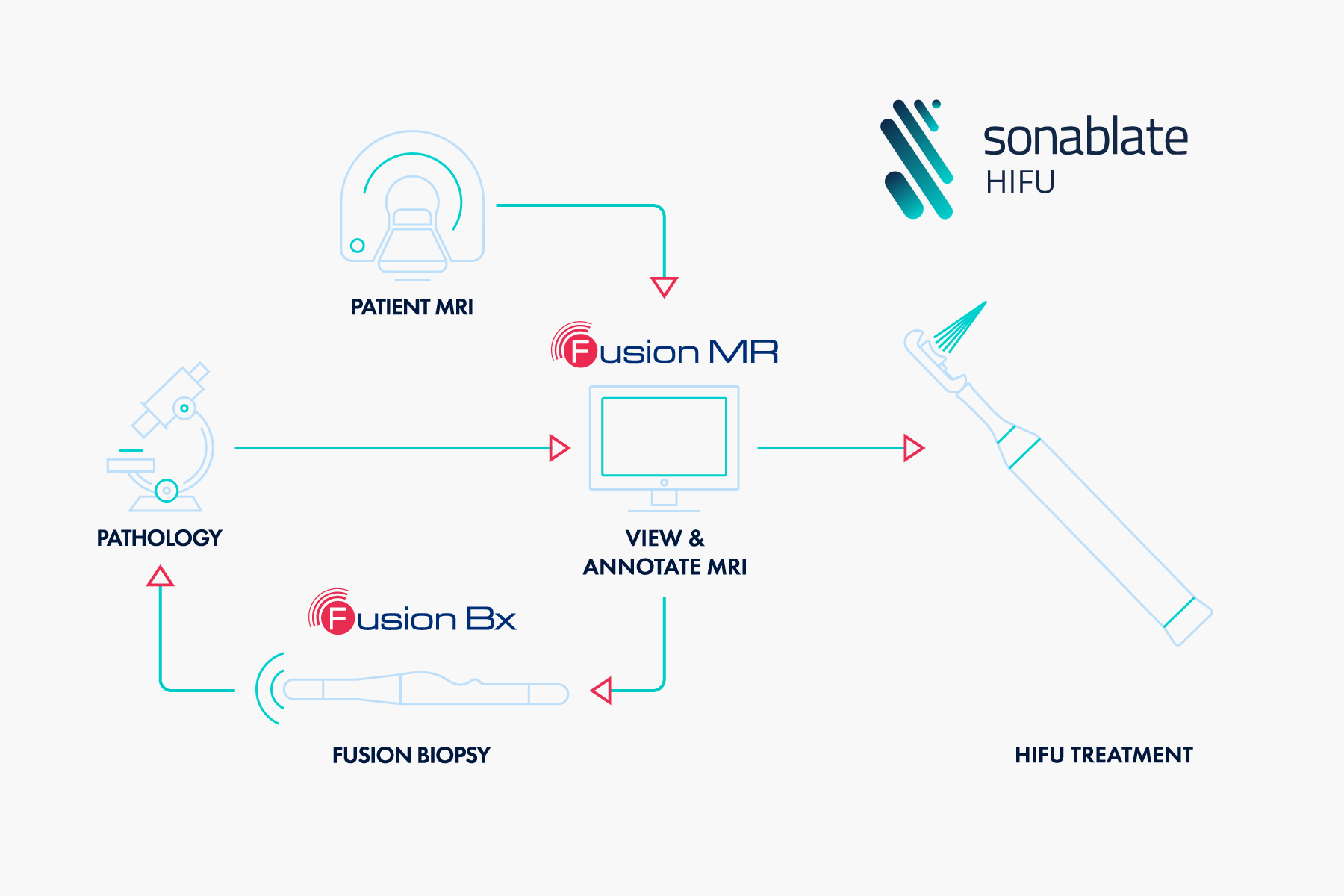 fhc sonablate HIFU workflow