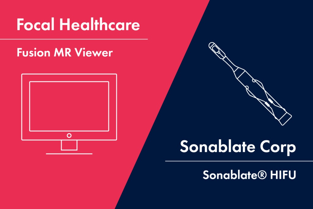 fusion MR x sonablate hifu