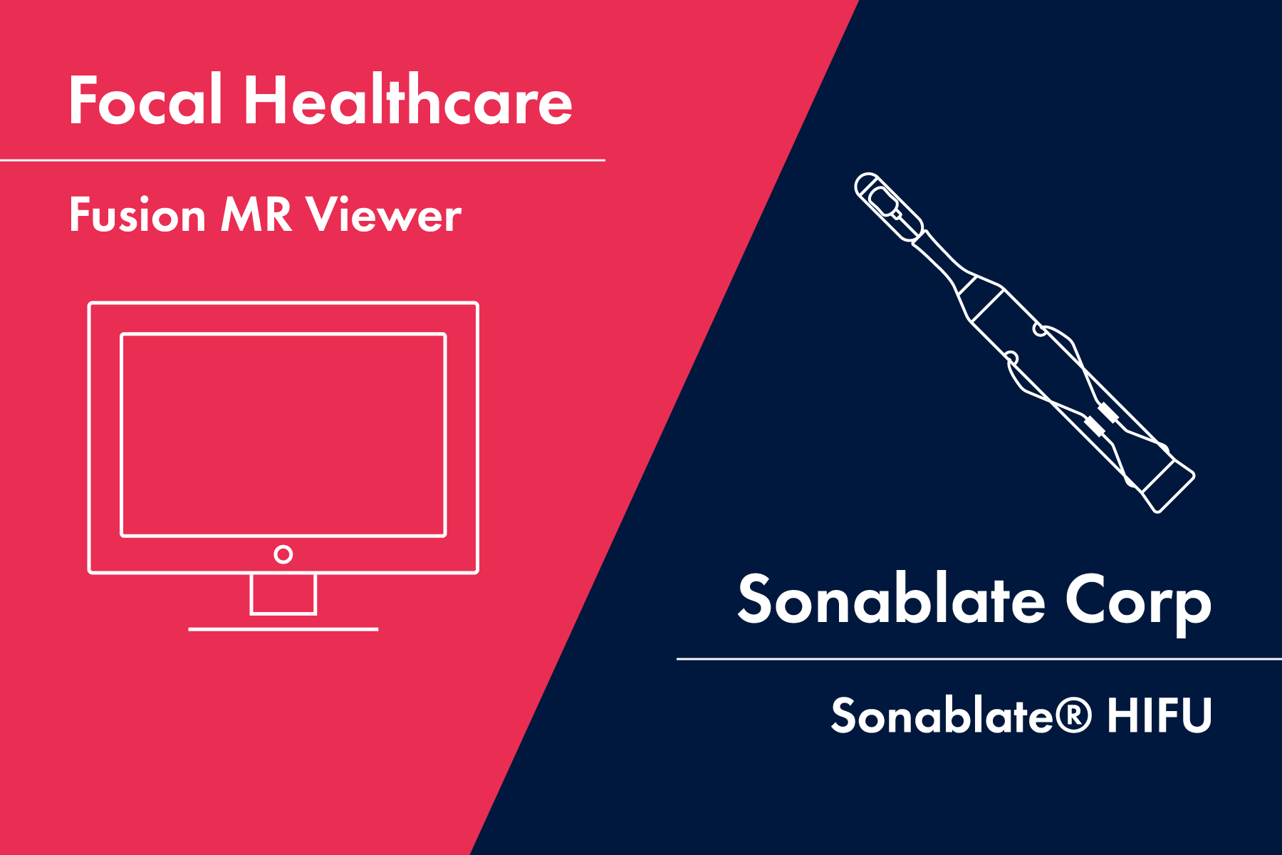 fusion MR x sonablate hifu