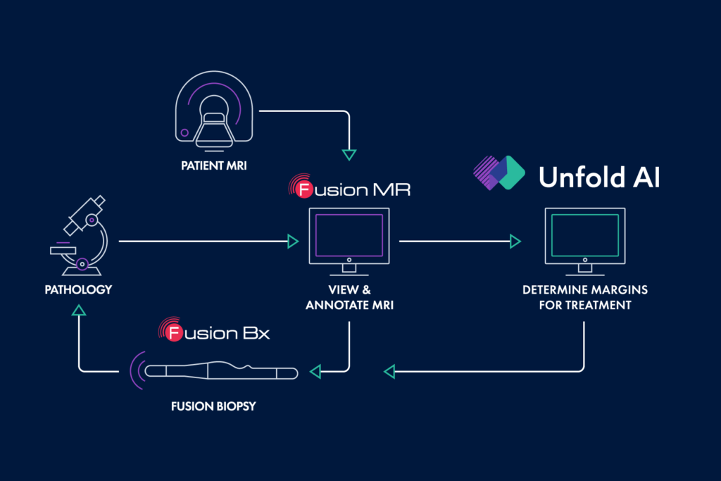 unfold AI fusion Bx workflow